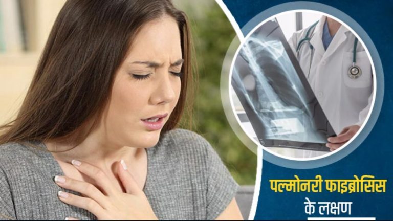 Pulmonary fibrosis: पल्मोनरी फाइब्रोसिस के ये लक्षण हो सकते हैं खतरनाक, जानें क्या है बचाव का तरीका