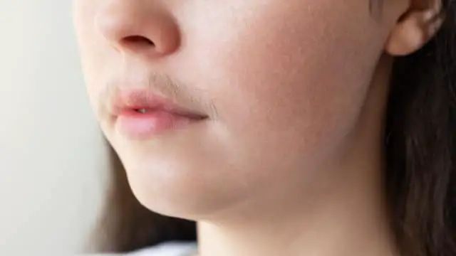 Unwanted Facial Hair: चेहरे पर उगे छोटे-छोटे अनचाहे बालों को हटाएगा ये फेस पैक