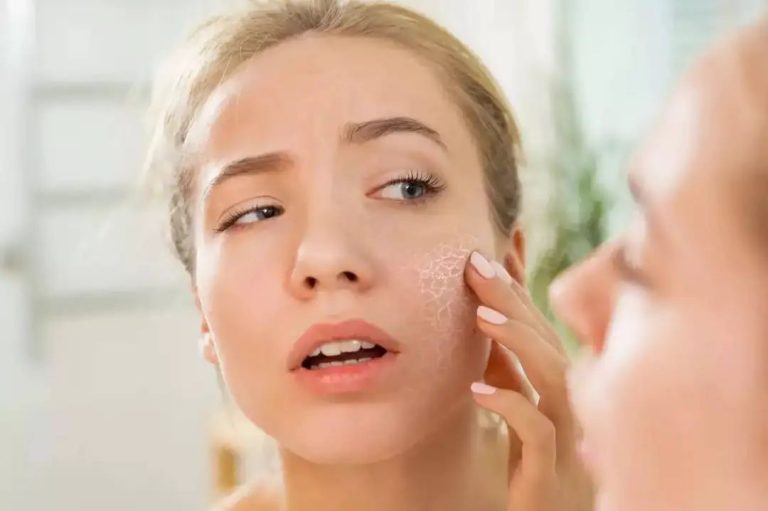 Skin Care Tips- भूलकर भी रसोई में रखी इन चीजों को ना लगाए चेहरे पर, हो सकती हैं समस्याएं