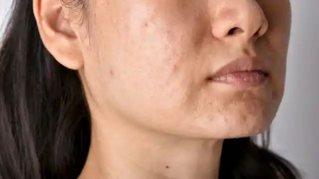 Dark Spot Removal: चेहरे पर दाग-धब्बों की वजह से दिखने लगा है फीकापन तो ये फेस पैक लाएगा चमक