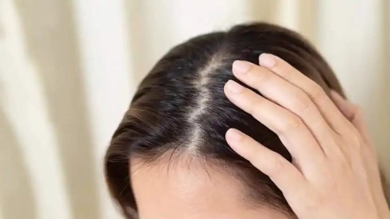 Hair Care Tips- आपकी स्कैल्प ड्राई हैं या ऑयली ऐसे करें पता, जानिए ट्रीटमेंट का तरीका
