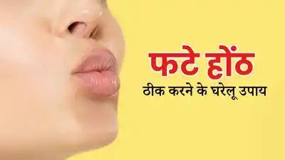 Chapped Lips Remedies: फटे होंठों की समस्या दूर करने के लिए अपनाएं डॉक्टर के बताए ये घरेलू उपाय