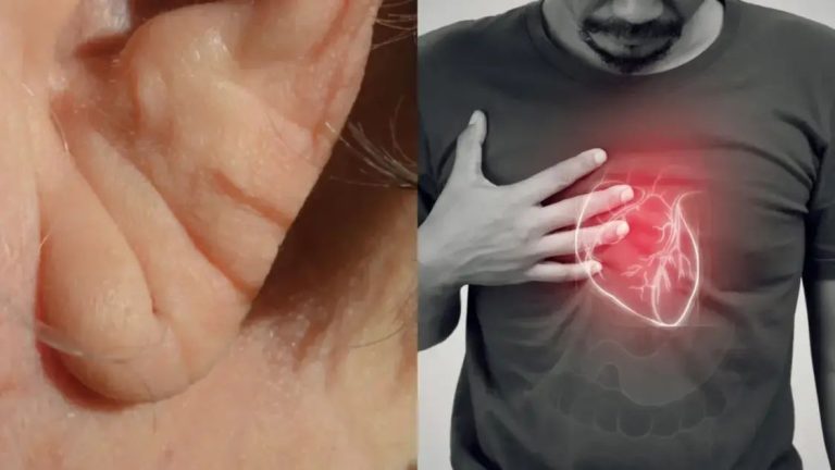 क्या कान पर बनने वाली लाइन हार्ट अटैक का लक्षण हो सकती है?