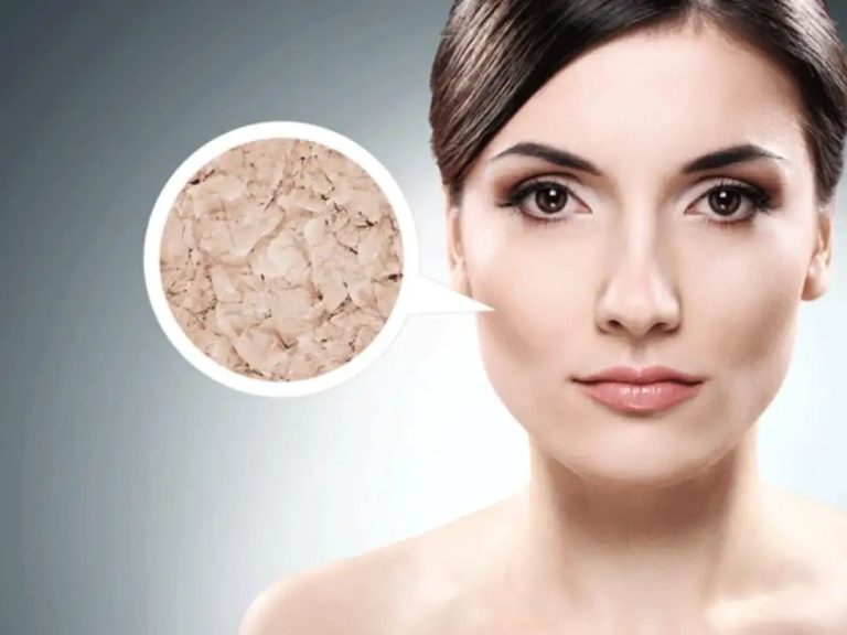 Skin Care Tips- क्या डेड स्किन की वजह चेहरे की खूबसूरती बिगड़ गई हैं, तो इस उबटन का करें इस्तेमाल
