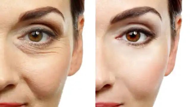 Skin Tighten Naturally:स्किन को नेचुरली टाइट करता है ये देसी नुस्खा, मिलता है बोटोक्स इफेक्ट