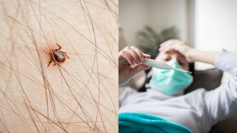 Lyme disease : एक कीड़ा ले सकता है आपकी जान, क्या है लाइम डिजीज?