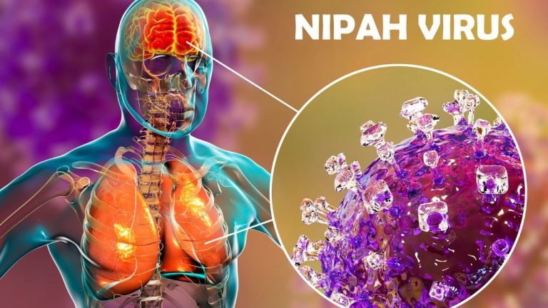 Nipah Virus : मंकीपॉक्स के बाद अब निपाह, कितना खतरनाक हो सकता है वायरस का ये कॉकटेल?